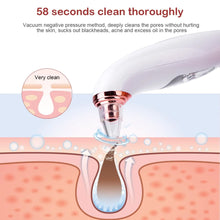 Visible Camera Blackhead Remover Vacuum Suction FLIXME WORLD